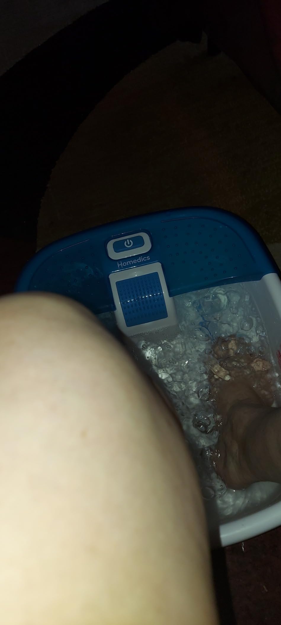 HoMedics Bubble Bliss Deluxe Foot Spa with Heat Massaging Arch, 3 Acupressure Attachments, Splash Guard, Raised Nodes Creates Bubbles, Improves Circulation, Soothe Tired Muscles customer photo 1