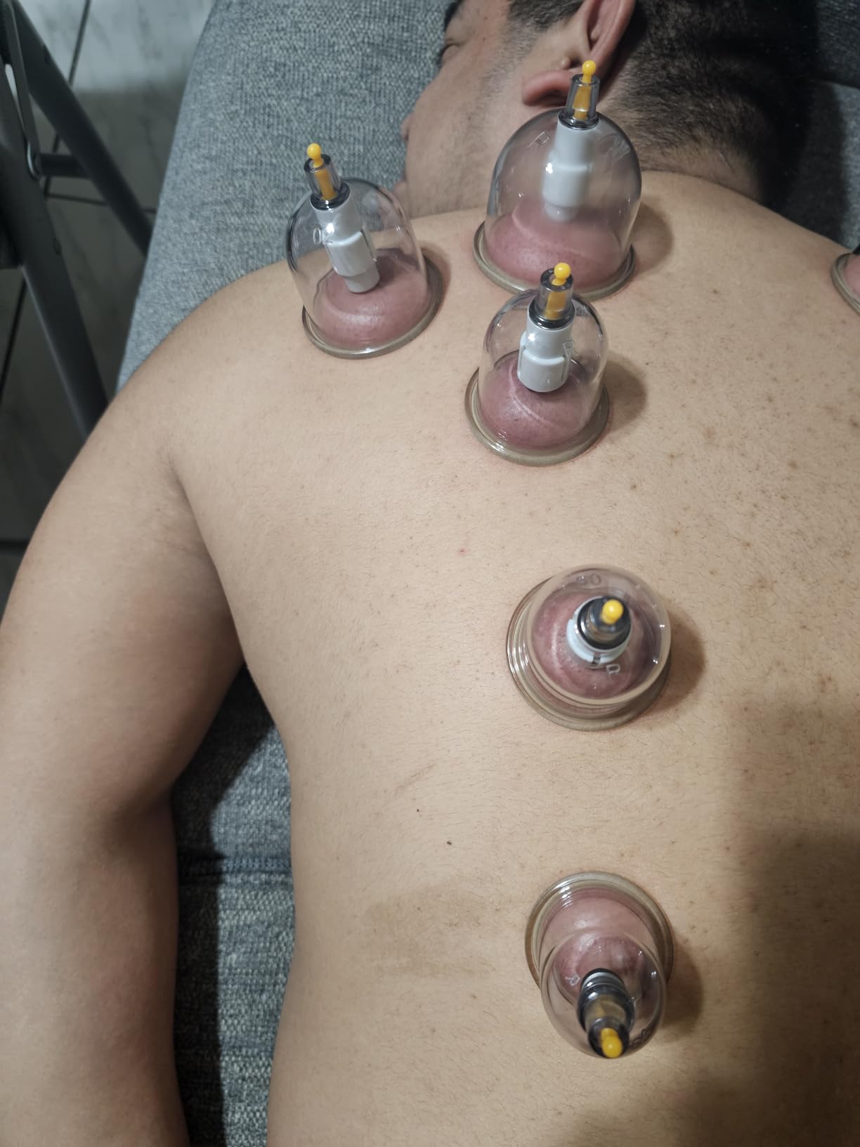 Cupping Set Massager, Cupping Kit for Massage Therapy | 18 Medical-Grade Massage Cups, 2 Hand Pumps and Cupping Booklet, Ventosas Para Masaje Muscular, Suction Cups For Body Therapy customer photo 2