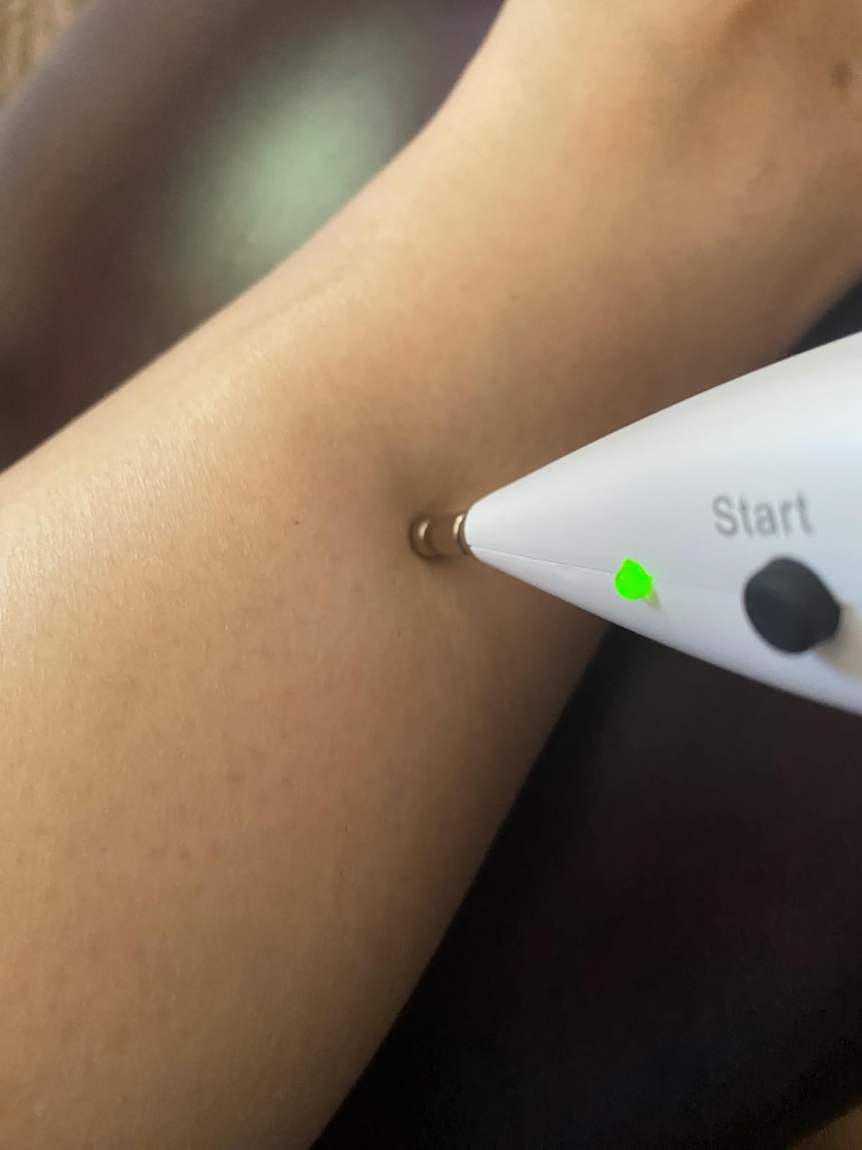 Electronic Acupuncture Pen for Pain Relief and Circulation, Rechargeable Meridian Energy Acupressure Pen Find Acupoints Automatically with 20 Levels Intensity and 3 Modes customer photo 1