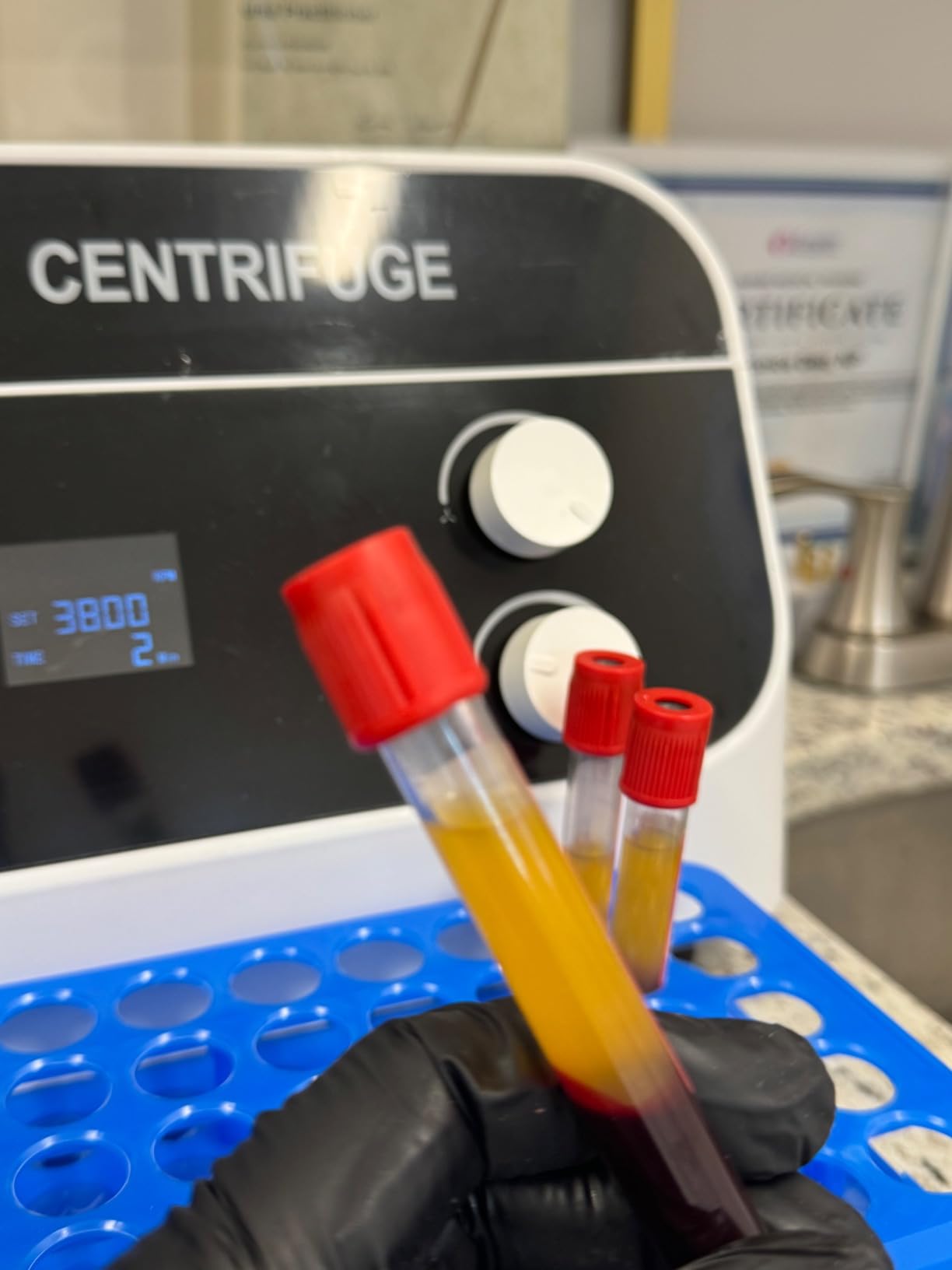 JIAWANSHUN Lab Benchtop PRP Centrifuge, 8x20mL 4000RPM LCD Display 110V customer photo 2